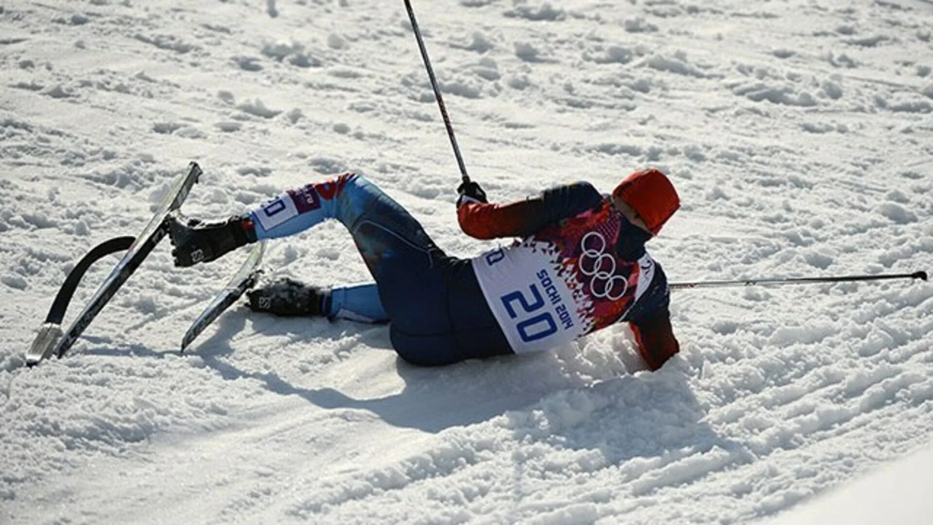 Травмы лыжниц в сочи