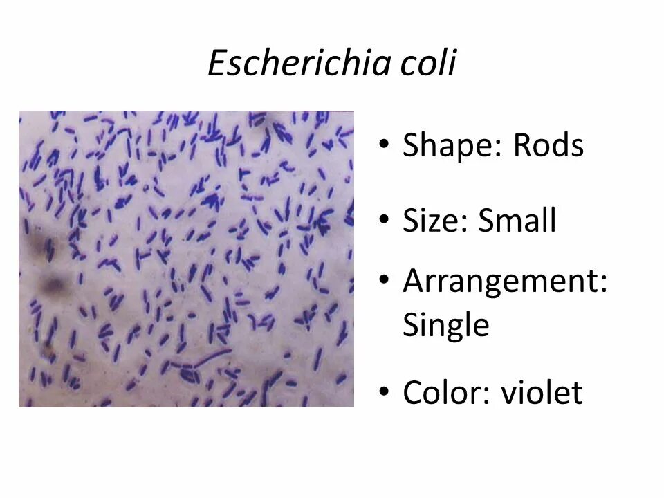 Эшерихия коли норма. Escherichia coli рисунок. Эшерихии в мазке. Эшерихия коли в мазке. Escherichia coli что это у мужчин