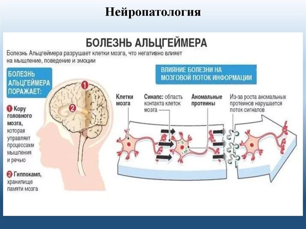 Болезнь айцгельмера это что. Очаг поражения при болезни Альцгеймера. Патогенез болезни Альцгеймера схема. Механизм развития болезни Альцгеймера. Болезнь Альцгеймера деменция.