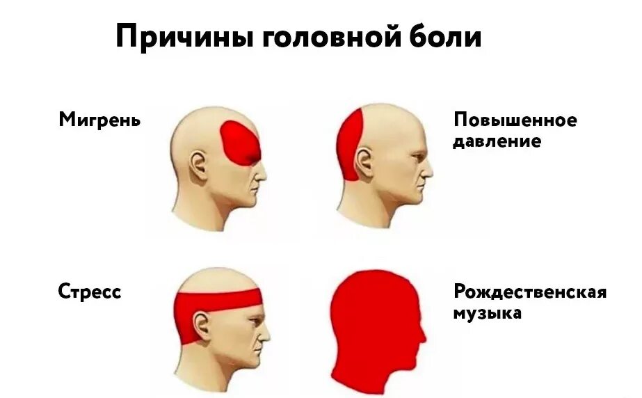 Сильная пульсирующая головная. Причины головной боли. Причины головнгйьболи. Головная боль в затылке. Сильно болит лоб и затылок.