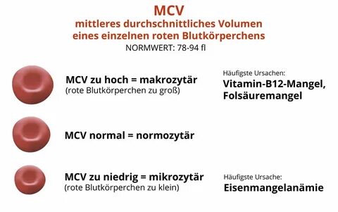 Mch