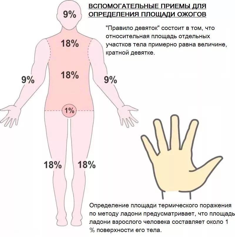 Ожоги проценты поражения. Площадь ожога правило девяток. Определение площади ожога. Определение площади ожоговой поверхности. Площадь поражения ожогов.