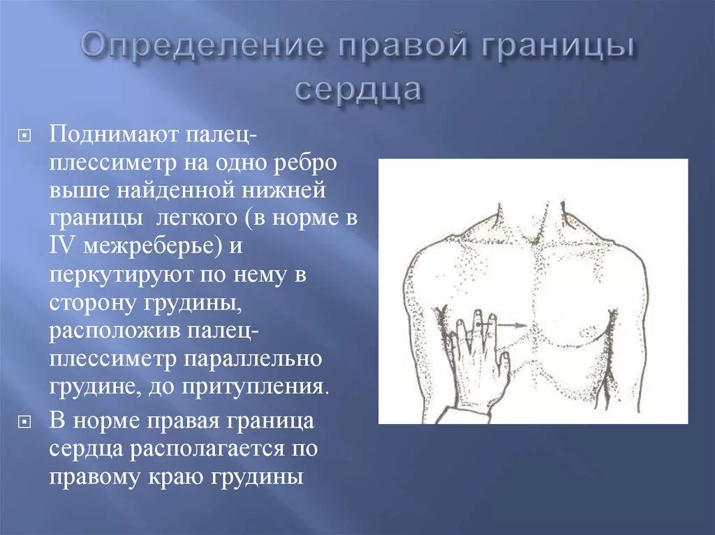 Определение границ сердца. Перкуссия палец плессиметр. Перкуссия сердца палец плессиметр. Границы легких определяются