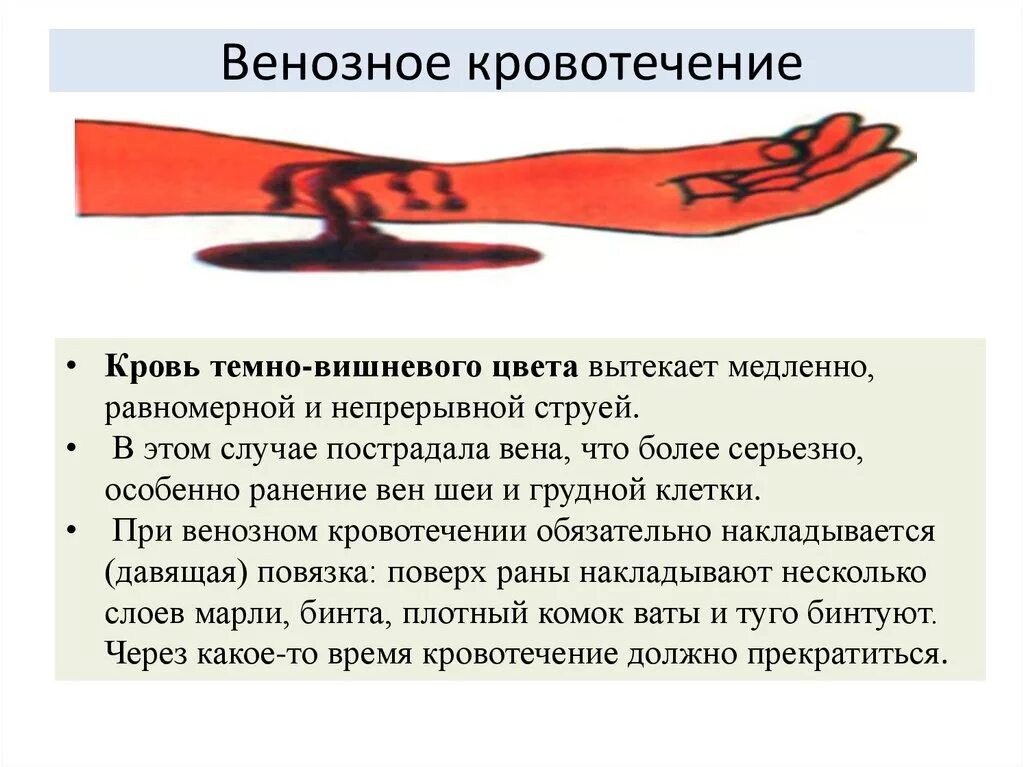 Что значит сильная кровь. Характеризуют венозное кровотечение:. Венозное кровотечение цвет. При венозном кровотечении кровь вытекает. Венозная кровотичение.