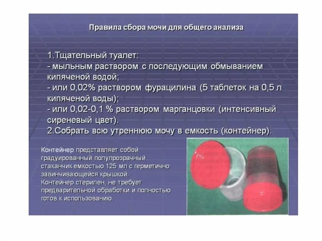 Сдача общего анализа мочи как собрать. Общий анализ мочи как собирать. Общий анализ мочи правильно собрать. Порядок сбора мочи на общий анализ. Сколько надо мочить