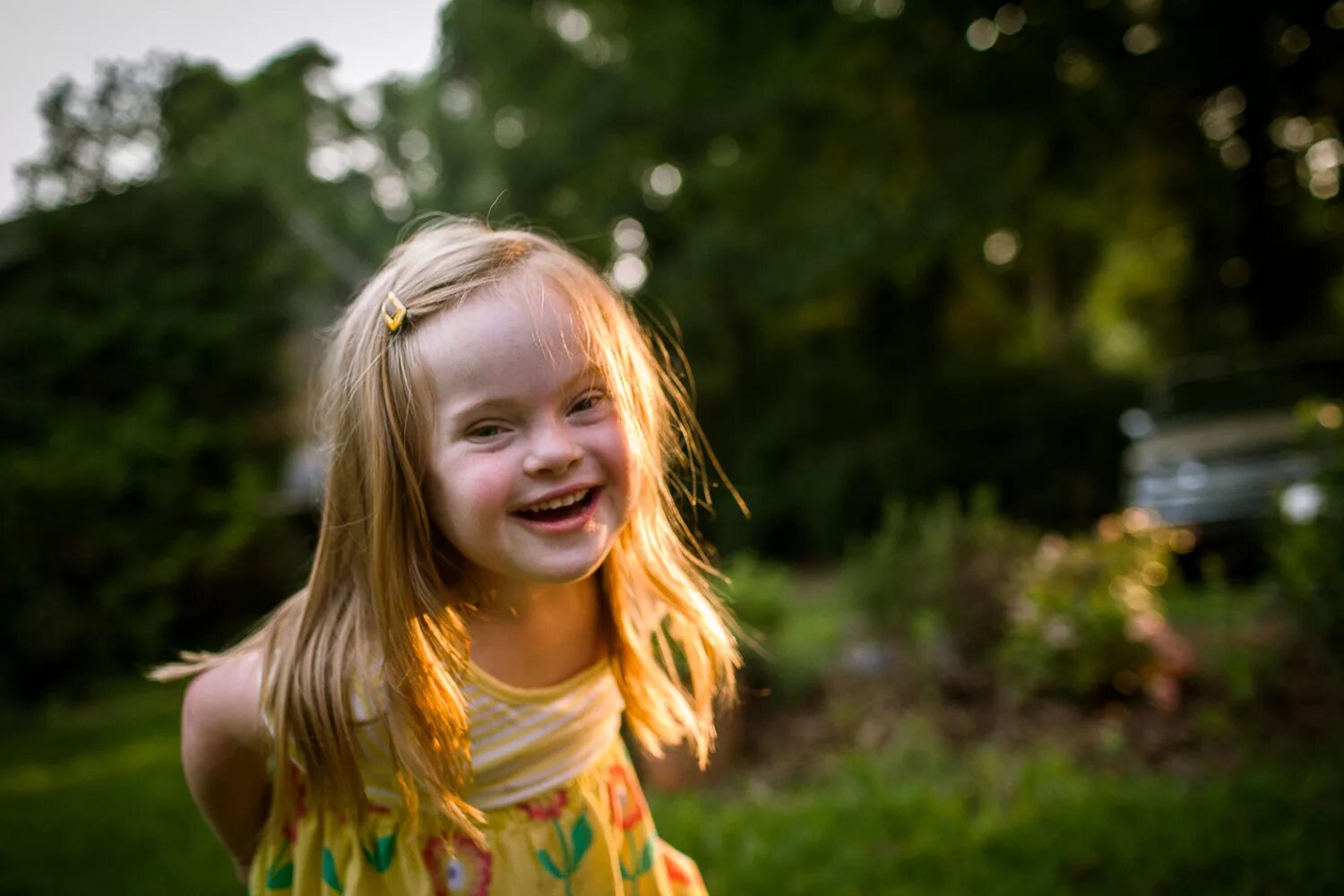 дети с синдромом дауна. синдром дауна. что значит солнечный ребенок. дети с синдромом даунизма. солнечные дети.