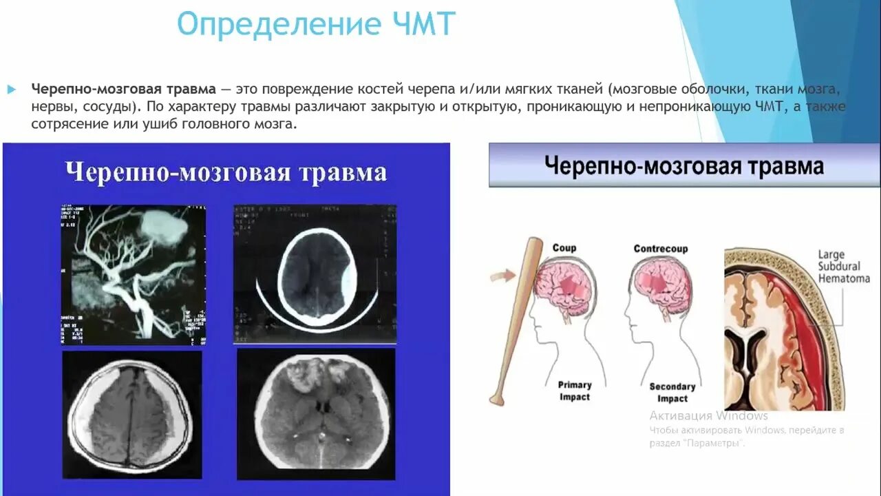 Тест сотрясение. Черепно-мозговая травма. Черепно-мозговая травма последствия. Черепно мозговая травма сотрясение. Клинические проявления черепно-мозговой травмы.