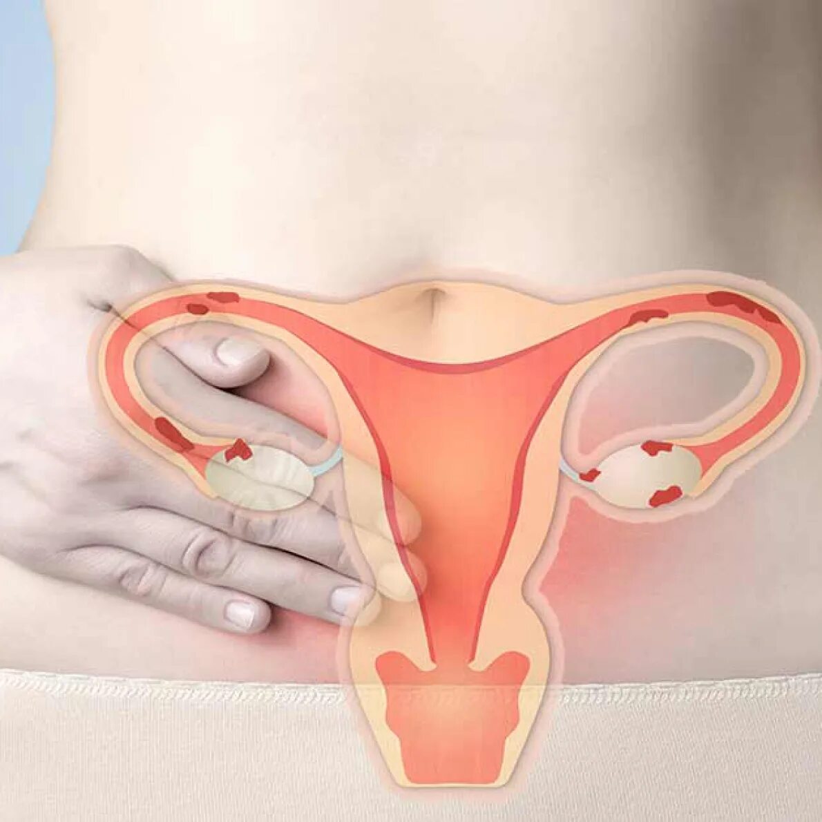 болит поясница болит живот. тянущ е боди в нищу живота. боли внизу живота при менструации. тянущее ощущение внизу живота. болит живот с левой стороны.