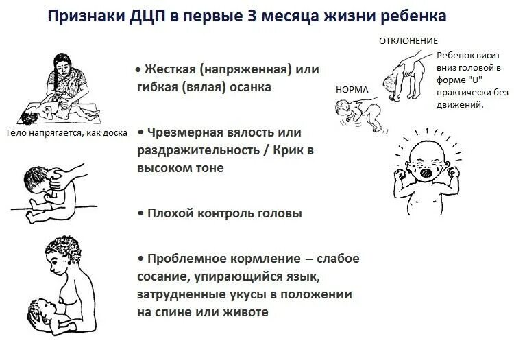 Симптомы ДЦП У грудничка в 2 месяца. Ранние проявления ДЦП У детей до года. ДЦП симптомы у детей до 1 года. Первые признаки ДЦП У грудного ребенка до 3 месяцев.