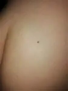 Что значит родинки в виде треугольника