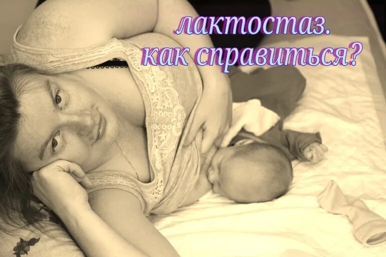 Лактостаз форум. Лактостаз в нижней доле. лактостаз при грудном вскармливании симптомы и фото. лечение лактостаза елена +ершова instagram lactostaz_ htlp.