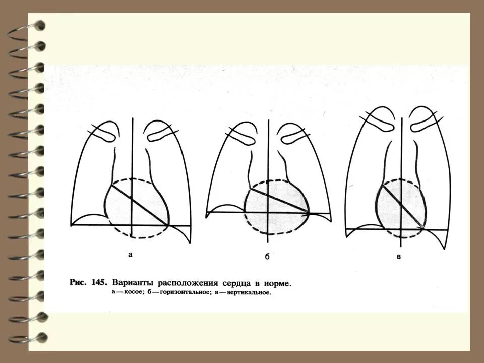 Вертикальное положение сердца. Варианты расположения сердца. Косое положение сердца. Типы расположения сердца. Расположение сердца в норме.