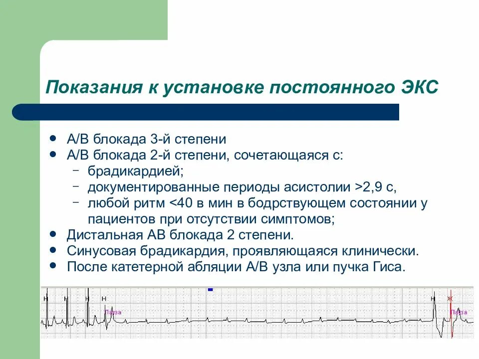 Блокада показания. Показания к имплантации постоянного экс. Показания к постоянной кардиостимуляции. Показания к постоянной экс. Показания к имплантации искусственного водителя ритма.