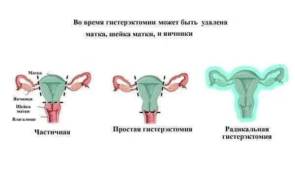 Матку девочка рассказ