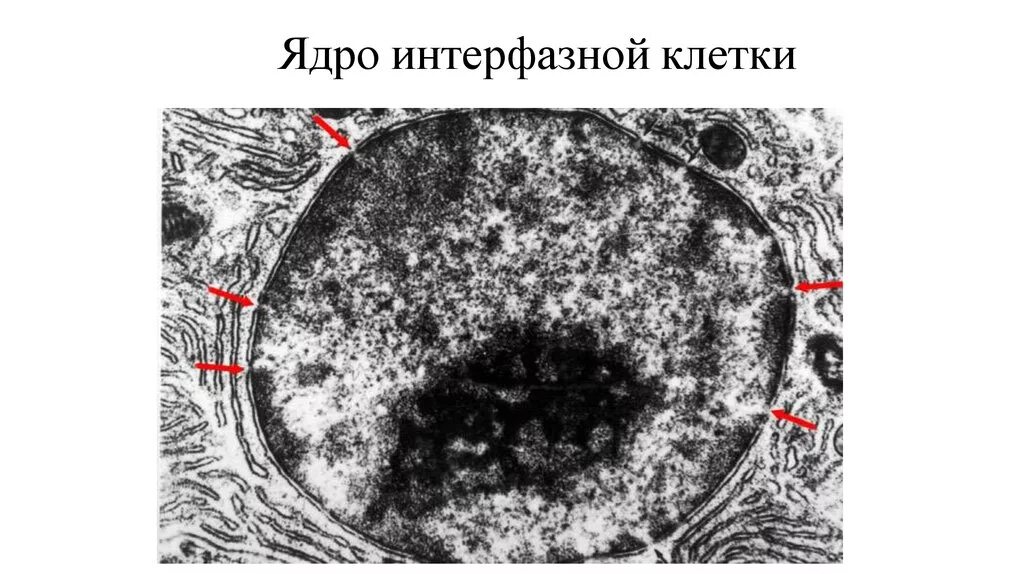 Ядро выпадающих из общего. Интеророзное ядро клетки. в ядре интерфазной клетки. строение ядра интерфазной клетки по электроннограмме. строение интерфазного ядра гистология.