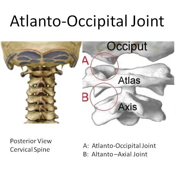 Атлантозатылочный сустав анатомия. Срединный атланто осевой сустав. Связки атланто затылочного сустава. Строение срединный атлантоосевой сустав анатомия.
