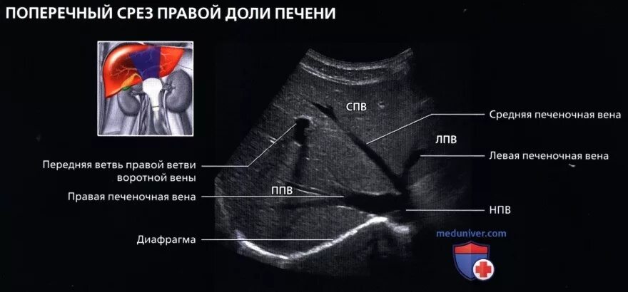 Норма долей печени