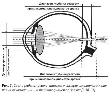 Какой элемент глаза выполняет функцию наведения резкости