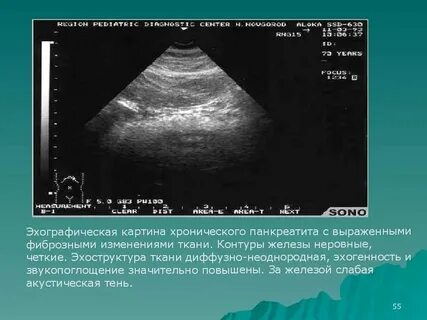 Структура поджелудочной диффузно неоднородная эхогенность повышена