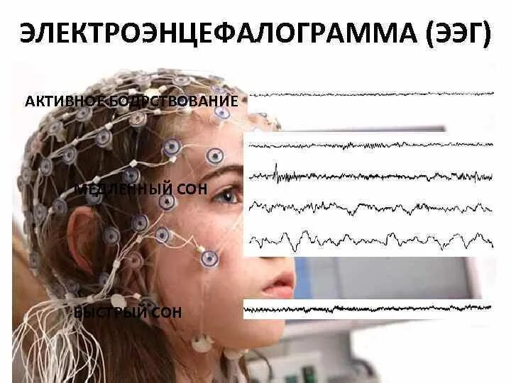 Электроэнцефалограмма. ЭЭГ. Человек на ЭЭГ. Электроэнцефалограмма сна.