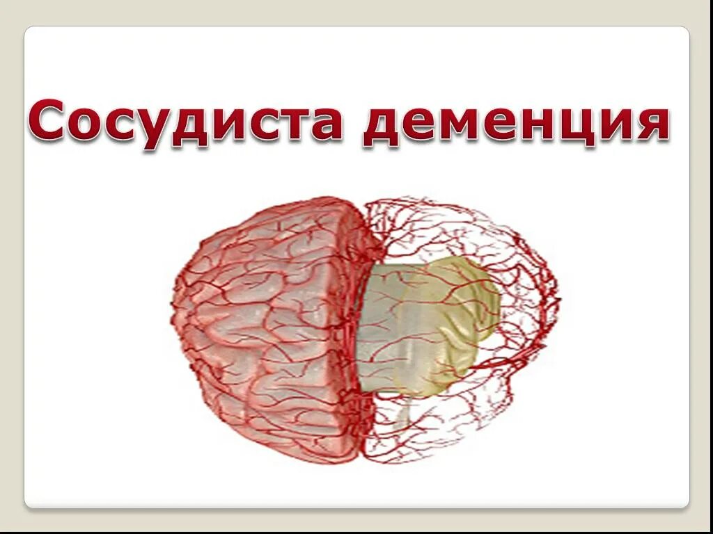 Сосудистое слабоумие. Деменция сосудов. Сосудистая деменция деменция. Сосудистая деменция этиология.