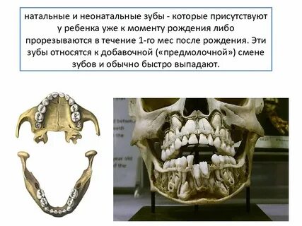 Нет зуба форум отзывы