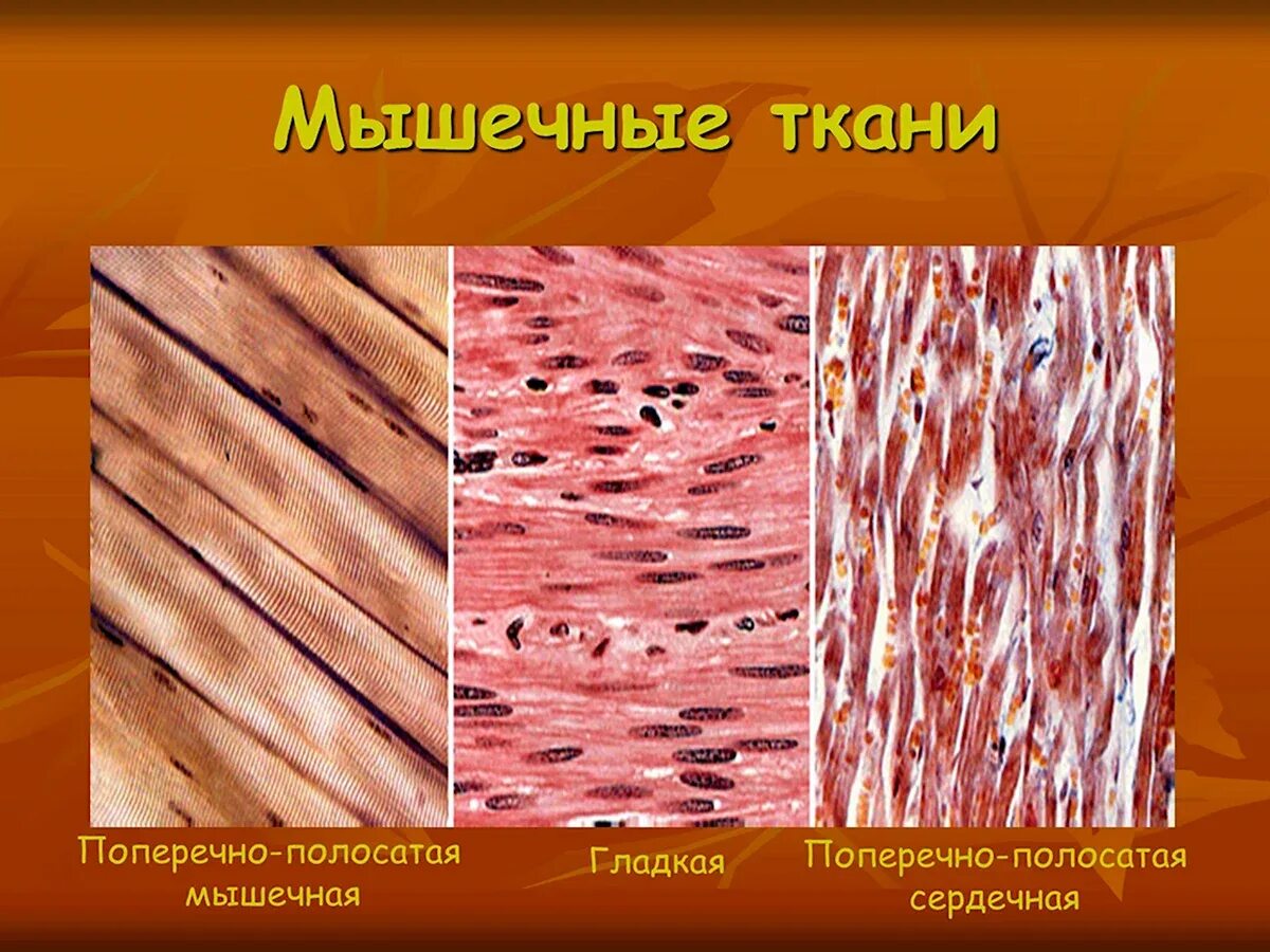 Мышечная клетка поперечно полосатой мышечной ткани. Гладкая мышечная ткань микропрепарат. поперечнополосатая и гладкая мышечная ткань. микрофотография гладкой мышечной ткани. ткани животных мышечная гладкая микропрепарат.