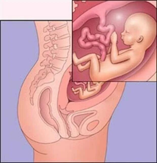20 недель тошнота. Ребёнок в 20 недель беременности в животе. Расположение плода на 20 неделе беременности. Расположение малыша на 20 неделе беременности. Малыш на 20 неделе беременности в животе.