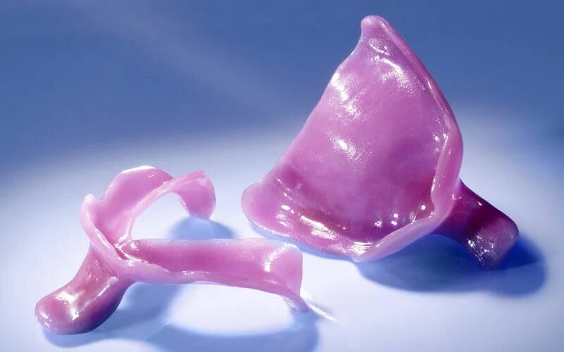 Оттиски для съемных протезов. Болтающийся гребень оттиск. Оттиски для съемных протезов. Одноэтапный двухфазный оттиск. И.