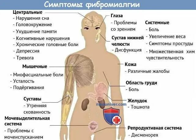 Симптомы фибромиалгии. Фибромиалгические точки. Фибромиалгия точки боли. Точки боли при фибромиалгии. Фибромиалгия симптомы причины и лечение