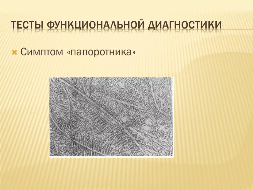 Номц. Симптом папоротника. Тесты функциональной диагностики симптом папоротника. Симптом папоротника в акушерстве. Симптом папоротника в гинекологии.