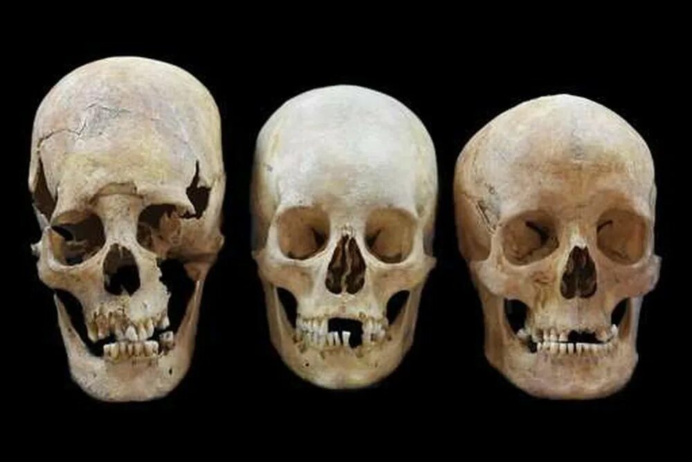 external structure of human female