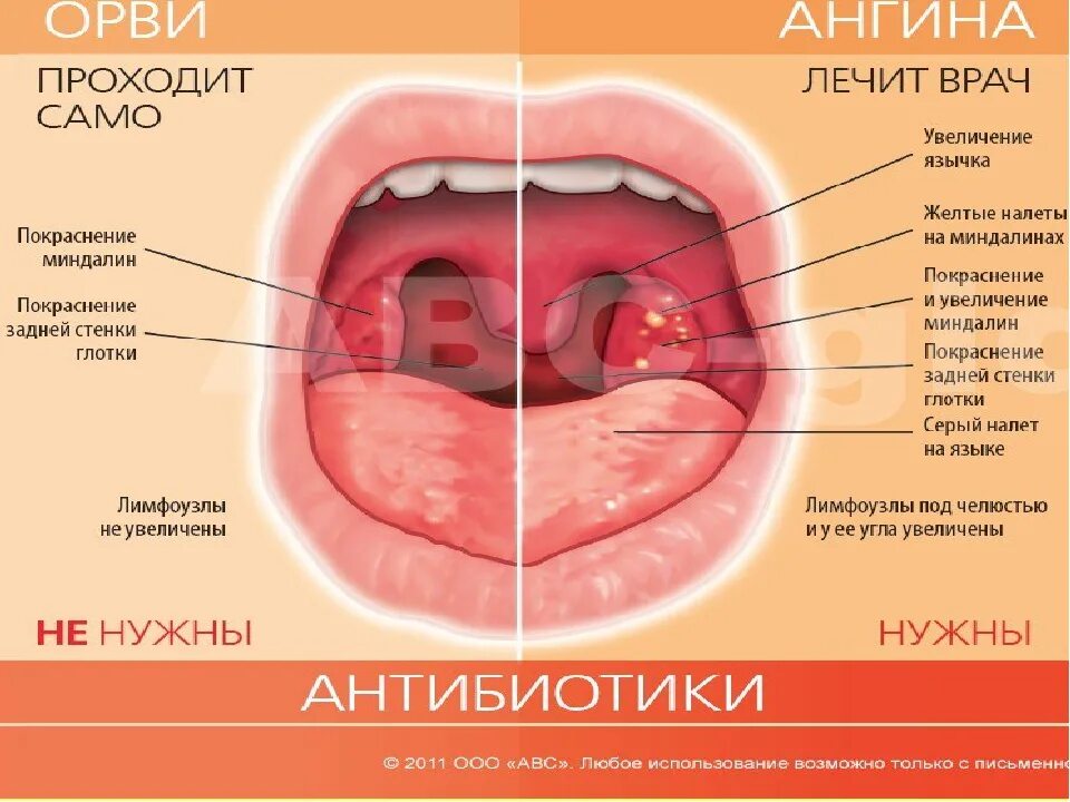 Во рту температура без