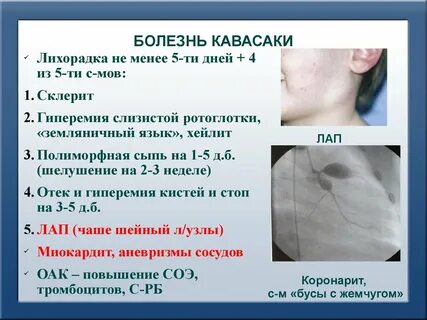 Слизисто кожный синдром