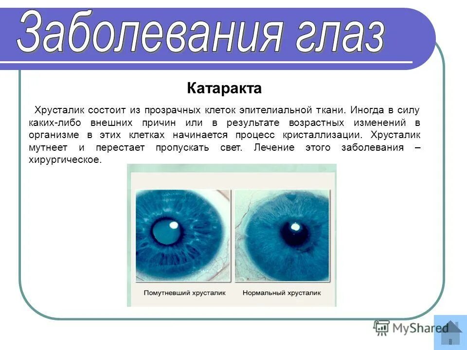 Заболевания органа глаза. Заболевания глаз доклад. Сообщение по биологии о заболеваниях глаз. Краткое сообщение о заболевании глаз. Глазные заболевания сообщение 8 класс.