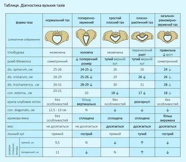 Размер таза 23 25