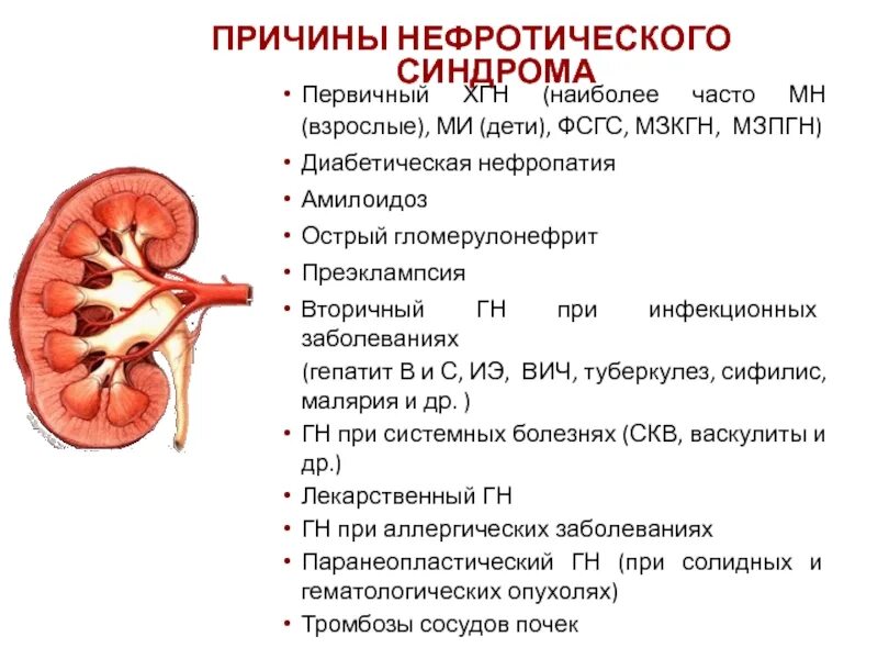 Размер почек у взрослых мужчин. Хронический гломерулонефрит нефротический форма. Мкб 10 пиелокаликоэктазия почки у детей. Симптомы нефропатии нефропатия почек. Острый гломерулонефрит нефротическая форма.