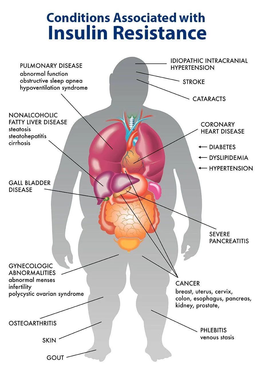 Нарушения связанные с питанием. Инсулина резистенция симптомы. Симптомы инсулин инсулинорезистентность. Инсулинорезистентность симп. Призраки инсулинорезистентности.