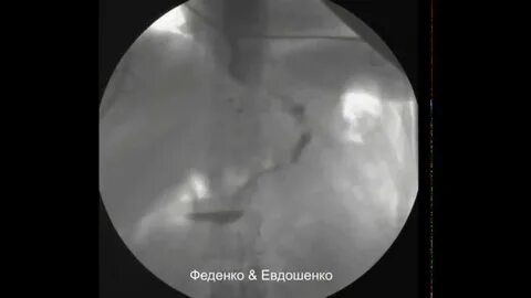 Что едят после рентгена