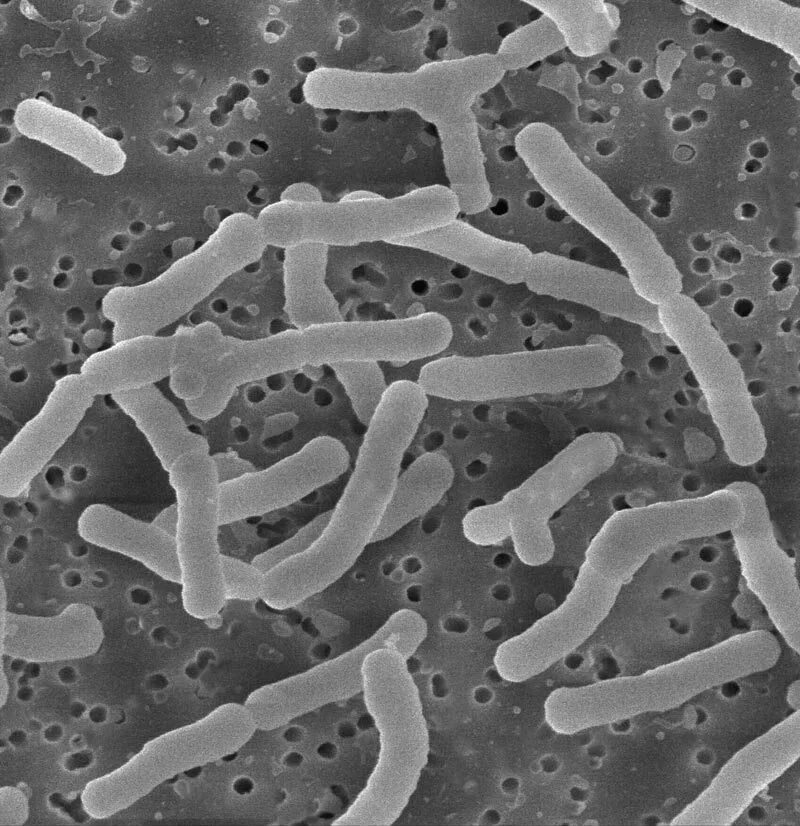 Палочка бифидобактерии. Lactobacillus Acidophilus в микроскопе. Lactobacillus Acidophilus под микроскопом. Лактобациллы Бревис. Ацидофильные лактобактерии (Lactobacillus Acidophilus).