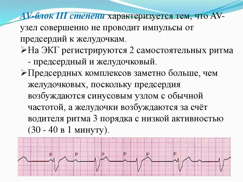 Нарушение проводимости предсердий. Экг нарушения ритма и проводимости. нарушения ритма на экг. экг при нарушениях ритма. экг признаки нарушения ритма.