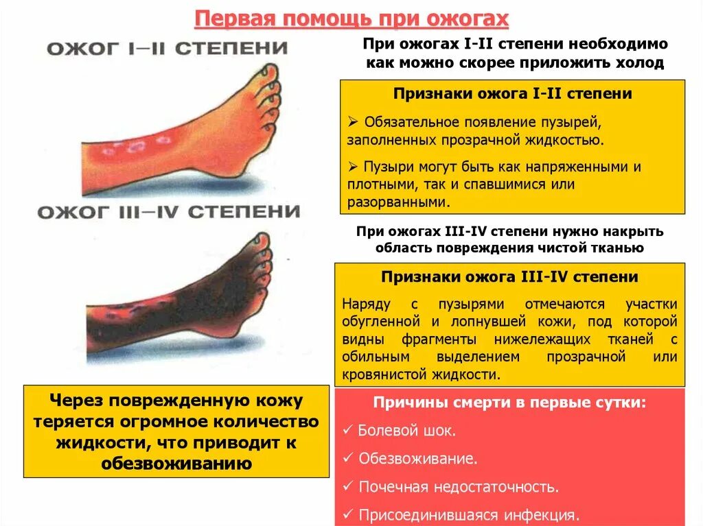 Тепловые травмы первая помощь. Оказание ПМП при ожогах 1 2 степени. Какова особенность оказания первой помощи при ожогах II, III И IV степени. Порядок оказания первой помощи при ожогах 3 степени..