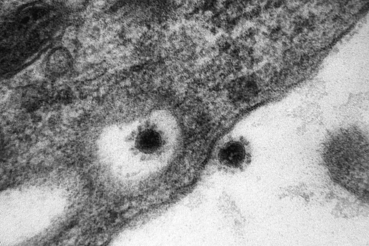 Заразен после ковида. SARS-cov-2 Дельта штамм. Вирус Covid 19 под микроскопом. Вирус SARS-cov-2 под микроскопом. Штаммы коронавируса под микроскопом.