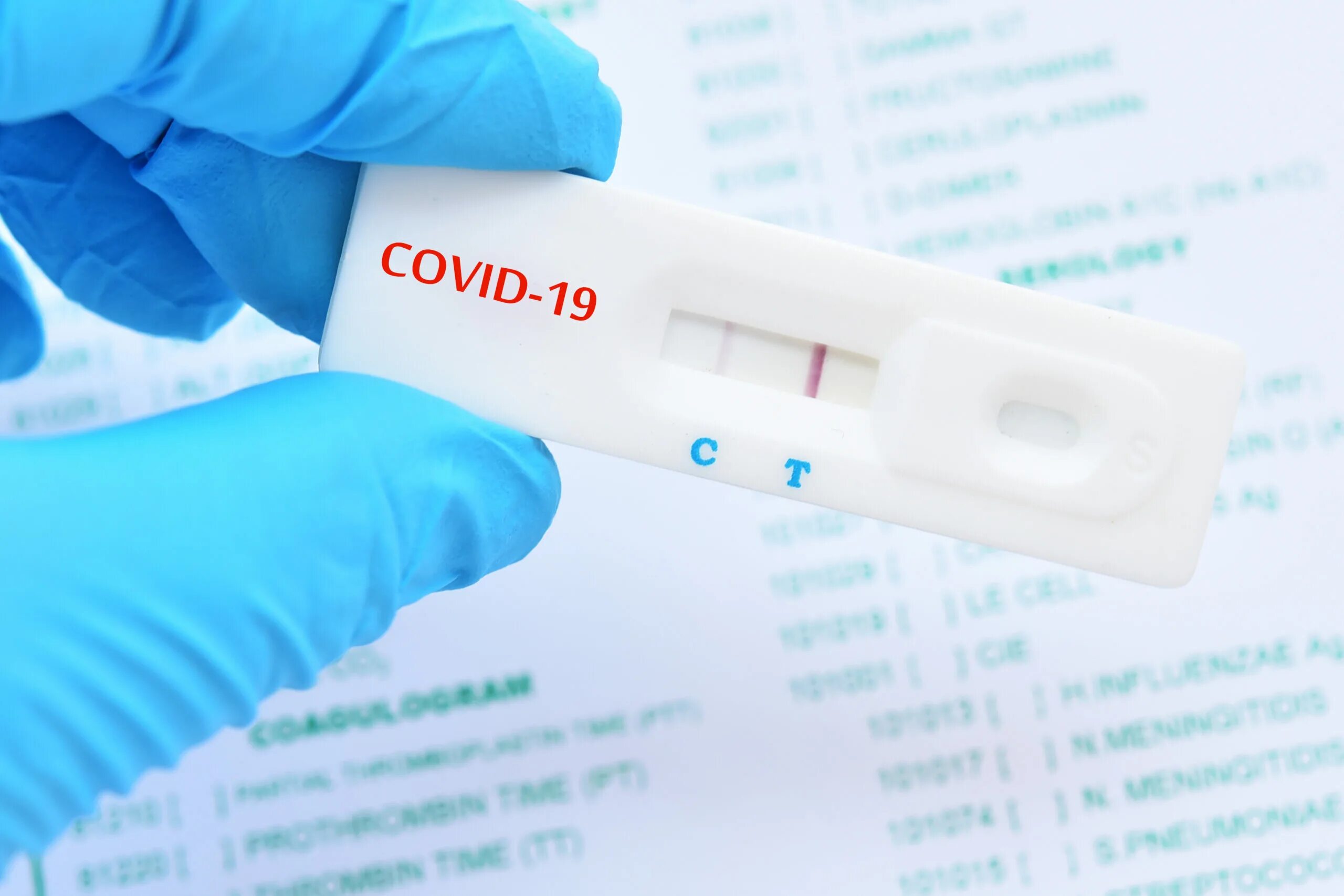 Терпит тест. Covid-19 AG Rapid Test. Covid Rapid Test. Рапид-Covid-19-антиген. Covid 19 positive Test.