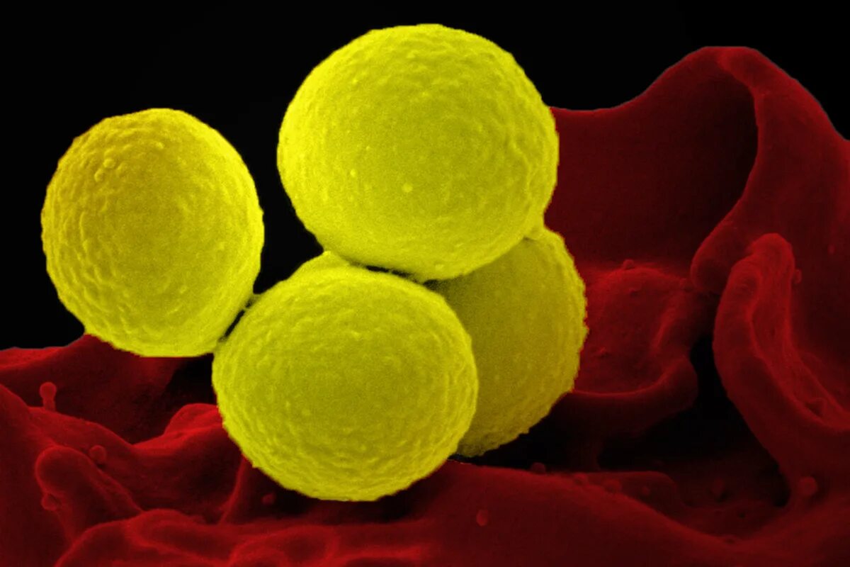 Staphylococcus aureus золотистый стафилококк. Стафилококки (s. aureus),. Стафилококкус ауреус. S. aureus золотистый стафилококк. Стафилококк ауреус болезни.