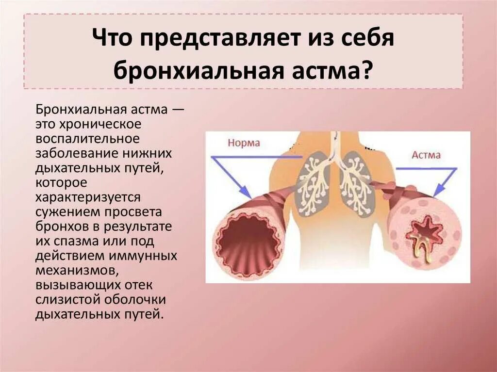 Заболевание сухие легкие. Бронхиальная астма. Болезнь бронхиальная астма. Заболевания органов дыхания бронхиальная астма.