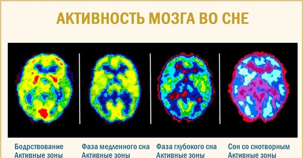 Время активного мозга. Активность мозга. Активность мозга во время сна. Деятельность мозга во сне. Фазы сна и активность мозга.