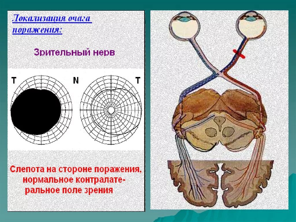 Структуры глаза зрительный нерв. Зрительный нерв анатомия. Зрительный нерв строение. Строение зрительного анализатора. Схема строения зрительного анализатора.