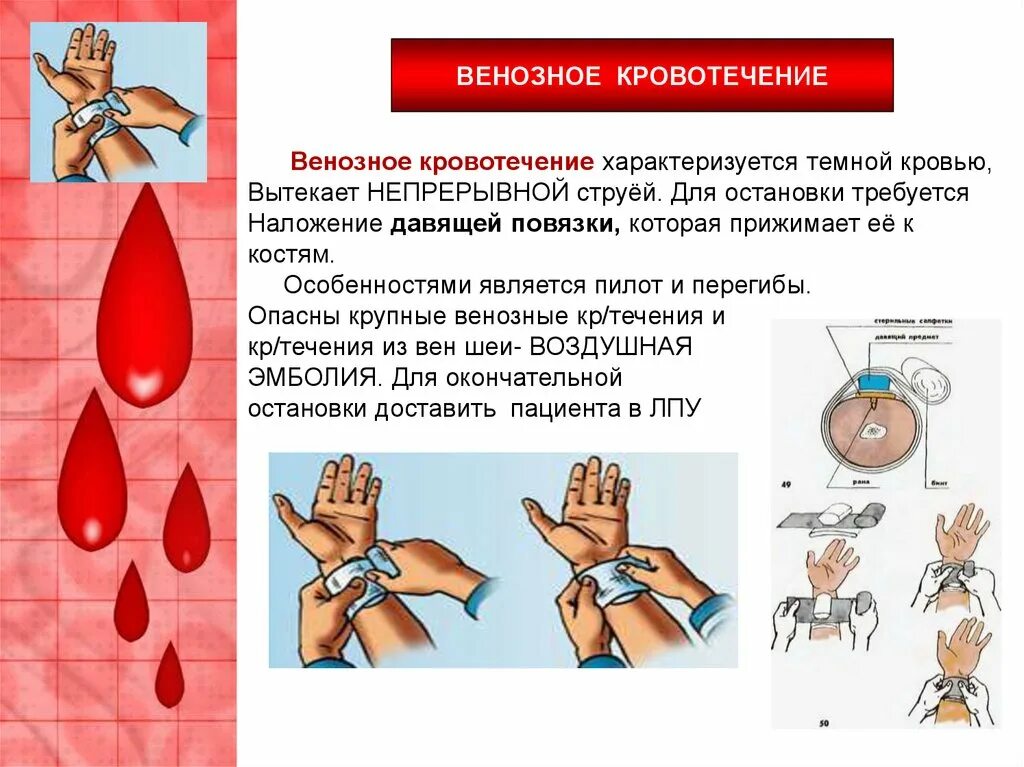 Примеры характеризующие венозное кровотечение