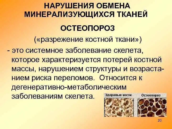 Системное заболевание скелета